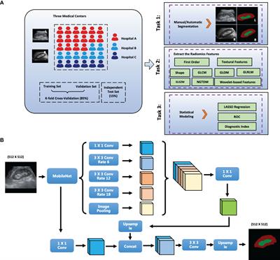 Auto-Segmentation Ultrasound-Based Radiomics Technology to Stratify Patient With Diabetic Kidney Disease: A Multi-Center Retrospective Study